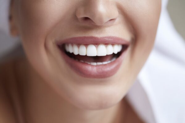 veneers-for-narrow-smiles-how-to-widen-your-smile