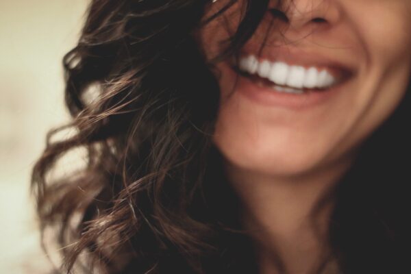 woman-smiling-with-perfect-teeth-veneers