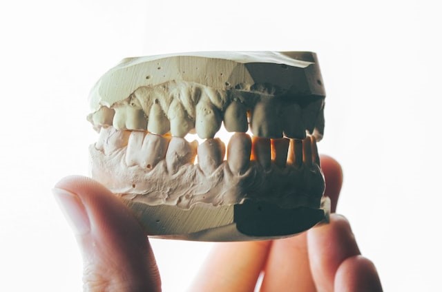 mould-of-teeth